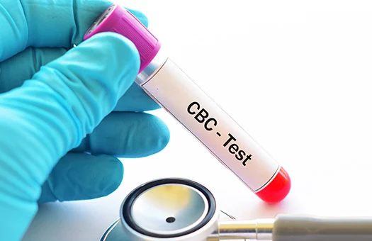 Complete Blood Count (CBC)